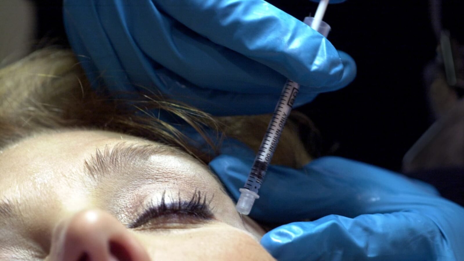 Galderma Reports Strong Growth as Weight-Loss Drug Use Drives Demand for Facial Fillers